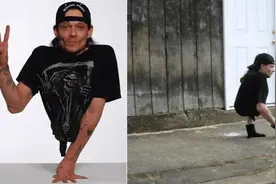 这个只有半个身体的男人，奇迹般打破了医生的死亡预言图片