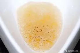 人尿肥是含哪些营养元素的肥料，适合在哪些作物上追施比较好？图片