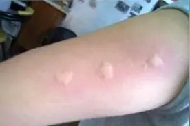 蚊子最怕“它”，洗净晒干卧室放一点，不用挂蚊帐，能睡安稳觉！图片