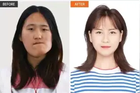 “歪脸”女孩的完美蜕变，追梦路上拒绝包装成网红，只想当教师。图片