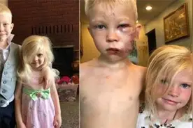 6岁哥哥为救妹妹甘愿赴死，血战恶犬被咬伤，美国队长送“盾牌”图片