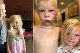 6岁哥哥为救妹妹甘愿赴死，血战恶犬被咬伤，美国队长送“盾牌”图片