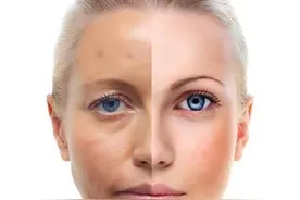 人为什么在年轻时候长的好看，年龄大了就变丑了呢？该怎么去预防图片