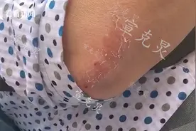 上海一老阿姨被车擦伤，开口索赔100万！网友：赔偿得有依据，不能漫天要价图片