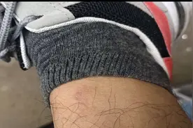 西安一外卖小哥送餐被狗咬伤 600多元医药费谁来承担？图片