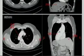 全球罕见！九江女子内脏都很不寻常图片