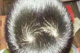 “一旋横二旋拧三旋打架猛”，头旋的“性格智商”论，唬到你了吗图片