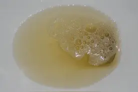 有泡沫尿就是肾脏出现问题了吗？医生坦言：这可不一定图片