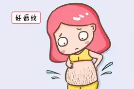 生过孩子肚皮花了咋回事？图片