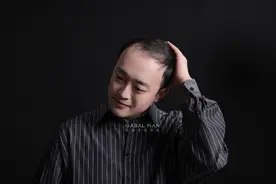 发际线过高，怎样拯救？这5个方法要收好图片