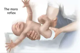 孩子睡觉时突然抖几下，是抽筋或抽风么？哪些迹象要看医生？图片