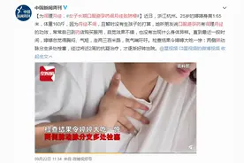 女子长期口服避孕药致肺梗？关于避孕药的真相你一定要了解图片