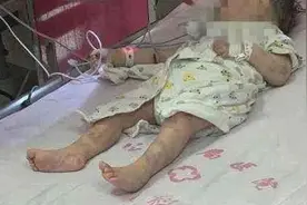 一岁婴儿遭母亲殴打住进ICU！救治6天仍未苏醒！警方：18岁生母所致图片