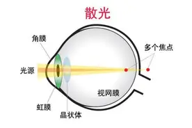 散光是什么如何测散光图片