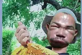 缅甸男子用火药炸马蜂窝！一名村民伤情严重身亡图片