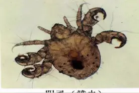 阴虱是什么？为什么现在很多人得阴虱？离不开2个传播途径图片