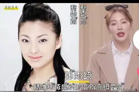 女明星整容前后大对比，整容后的她们星途都怎么样了呢？图片