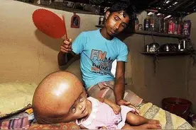 有趣的冷门小知识分享，你知道世界上最大的婴儿脑袋有多大吗？图片