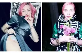 62岁麦当娜晒性感照，撩裙妩媚露大腿根部伤疤，每天复健6小时图片