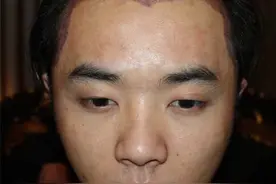 疑似华晨宇女友发声，曝华晨宇整容现场照，还指张碧晨插足当小三图片