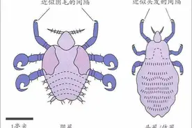 同样是虱子，为什么头虱、体虱、阴虱不能离开自己的地盘？图片