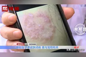 女子莫名染上顽疾，皮肤起红疹，竟是“撸猫”惹的祸图片