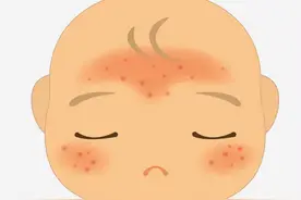 宝宝出现这些皮肤问题，要当心图片
