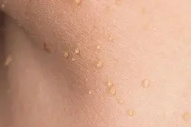 脖子和腋下的“小肉粒”是什么？可以用手直接揪掉吗？建议了解下图片