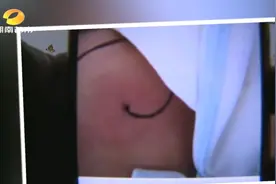 揪心！3月大婴儿心脏被绣花针刺穿，竟然是孩子妈妈所为？图片