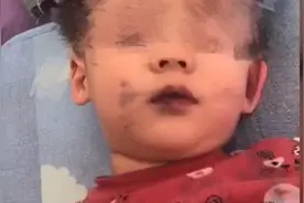 孩子吃蛋糕手脸沾上黑色素两天没洗掉 店家：是食用色素 有合格检测报告图片