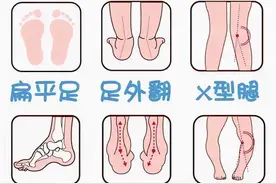 「未来医生」宝宝穿鞋有讲究，这几点家长一定要记住图片