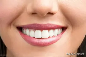 口腔专家告诉你牙齿不白是什么原因图片