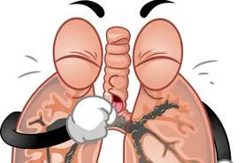 咳嗽查出了肺癌，医生说潜伏期有10年，每年体检为什么查不到？图片