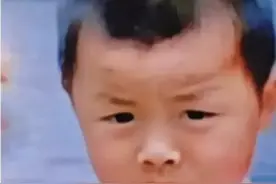 许敏：我当初梦见儿子在河南。田静：郭威头上的疤医学上这样解释图片