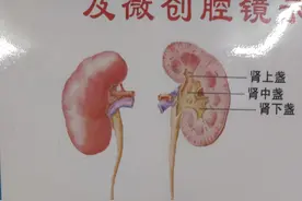 包皮过长或者包茎需要切吗？图片