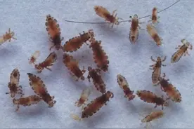 七八十年代人头身上几乎都有虱子，为何后来忽然消失不见了？图片