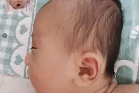 “大饼脸”宝宝，通常官配“平底锅”的后脑勺，宝宝脸大谁之错？图片