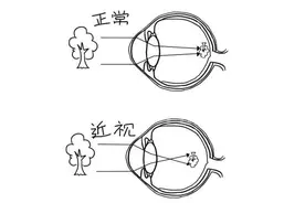 几张漫画让你看懂近视、远视、散光！图片