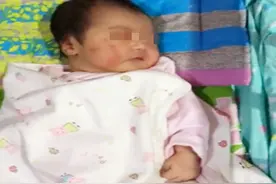 宝宝健不健康，其实头发就是“风向标”，若有这些特征，可能遭罪图片