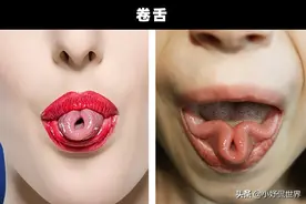 罕见的特征：仅在少数人身上存在的5个罕见的身体特征图片