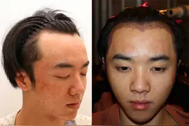 31岁华晨宇被造谣植发整容削骨，如何回应？张碧晨邓紫棋情感曝光图片