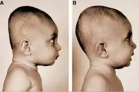 老人喜欢给孩子睡“扁头”，真的好吗？父母早点制止，对孩子好图片