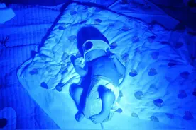 儿子黄疸高我们这样处理供大家参考图片