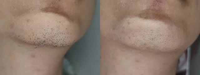 ʼ����ֵ�������� ��ü��ʿ�綯���뵶T3����