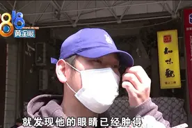 本想去电影院重温旧时光，结果孩子眼睛肿成拳头？图片