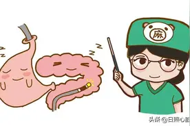 警惕隐秘的“定时炸弹”——无蒂锯齿状息肉图片