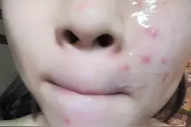 芦荟胶的正确用法：不是“直接”涂！方法弄错了，难怪会没有效果图片