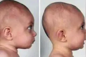 “脑勺高，聪明包”，宝宝头型与智商挂钩？这种说法成立吗？图片