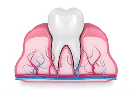 两年多时间补了大概10颗牙的心酸过程，引以为戒图片
