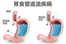 消化不好，吃啥都难受，做到这15点，提高你的消化能力图片